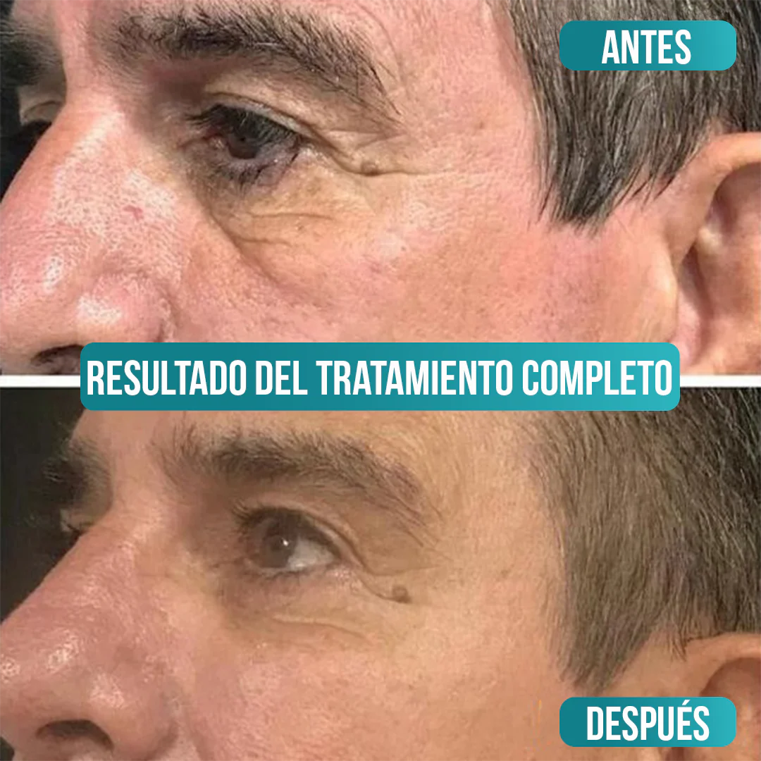 Crema Antiedad Masculina Sadoer con Vitamina C, Ácido Hialurónico y Niacinamida